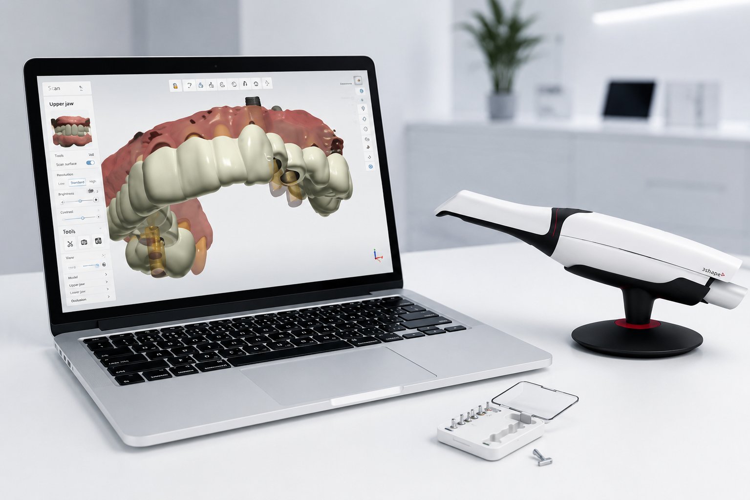 Software de planificación 3D y escáner intraoral