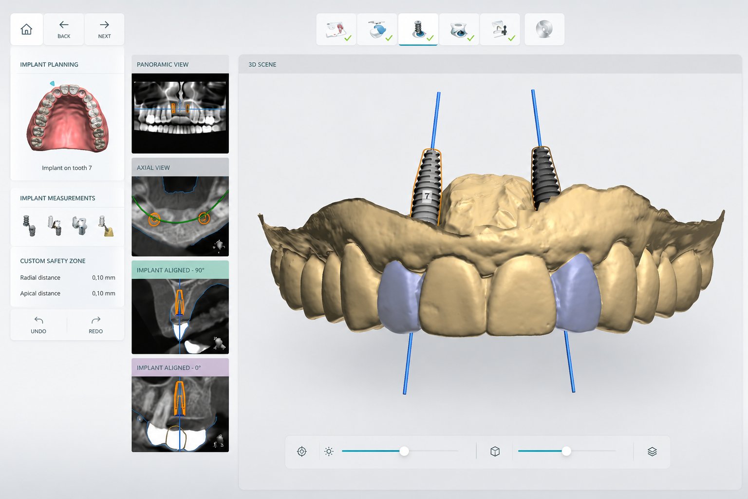 Software de planificación de implantes en 3D